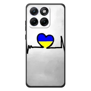 Силиконовый Чехол на Motorola Edge 70 Fusion Plus (Я-Украина) (Украинская кардиограмма)