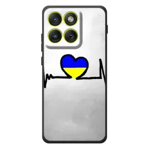 Силиконовый Чехол на Motorola Edge 70 (Я-Украина) (Украинская кардиограмма)
