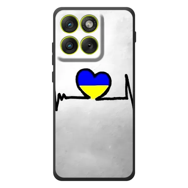 Чехол с рисунком «Украинская кардиограмма» для Motorola Edge 70 Чехол с рисунком «Украинская кардиограмма» для Motorola Edge 70
