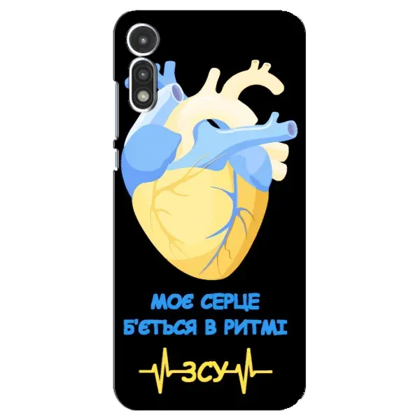 Чехол с рисунком «Ритм ЗСУ» для Motorola MOTO E 2020 Чехол с рисунком «Ритм ЗСУ» для Motorola MOTO E 2020