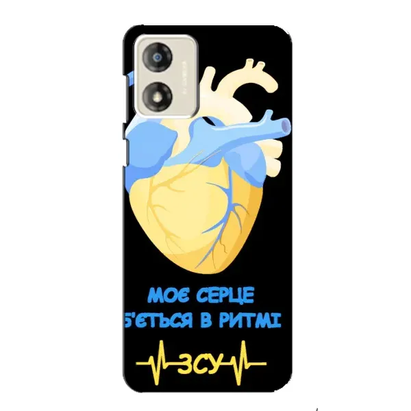Чехол с рисунком «Ритм ЗСУ» для Motorola MOTO E13 Чехол с рисунком «Ритм ЗСУ» для Motorola MOTO E13