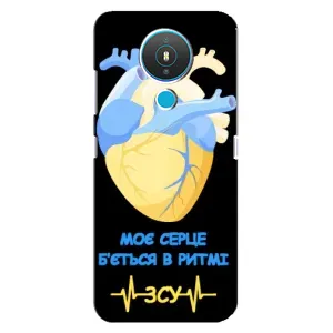 ЗСУ Чехлы (TPU) для Nokia 1.4
