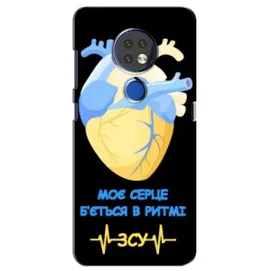 ЗСУ Чохли (TPU) для Nokia 6.2 (2019) (Ритм ЗСУ)