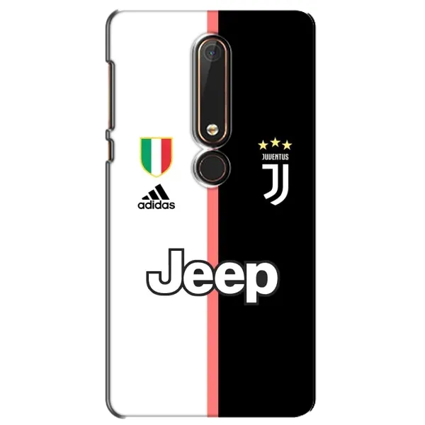 Чехол с рисунком «Juventus» для Nokia 6 2018
