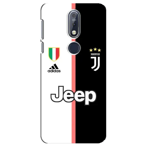 Чехол с рисунком «Juventus» для Nokia 7.1 (2018) Чехол с рисунком «Juventus» для Nokia 7.1 (2018)