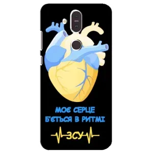 ЗСУ Чехлы (TPU) для Nokia 8.1 , Nokia 8 2018 (Ритм ЗСУ)