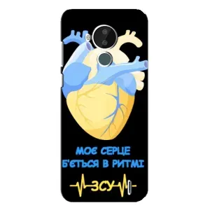 ЗСУ Чехлы (TPU) для Nokia C30 (Ритм ЗСУ)
