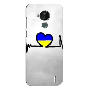 Силіконовий Чохол на Nokia C30 (Я-Україна) (Українська кардіограма)