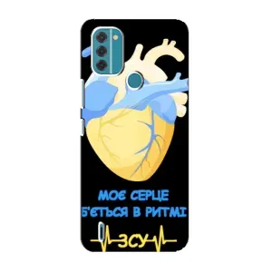 ЗСУ Чехлы (TPU) для Nokia C31 (Ритм ЗСУ)