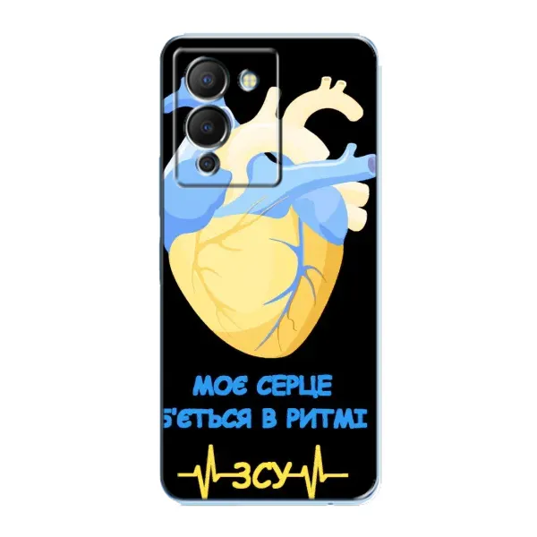 Чехол с рисунком «Ритм ЗСУ» для Infinix Note 12 (G96) Чехол с рисунком «Ритм ЗСУ» для Infinix Note 12 (G96)