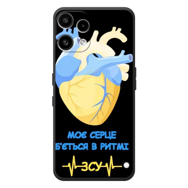 Чехол с рисунком «Ритм ЗСУ» для Nothing Phone (3a) Lite Чехол с рисунком «Ритм ЗСУ» для Nothing Phone (3a) Lite