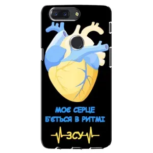 ЗСУ Чехлы (TPU) для One Plus 5T