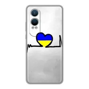 Силиконовый Чехол на OnePlus Nord CE4 Lite (Я-Украина) (Украинская кардиограмма)