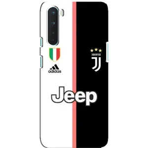 Чехлы с ТОП Футбольными клубами на OnePlus Nord (Juventus)