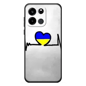Силиконовый Чехол на OnePlus Turbo 6V (Я-Украина) (Украинская кардиограмма)