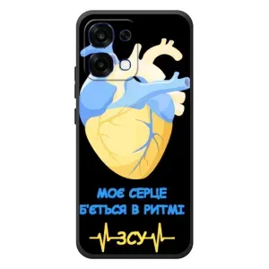 ЗСУ Чехлы (TPU) для OPPO A6 Pro (Ритм ЗСУ)