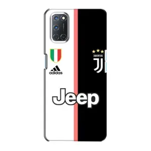 Чохоли з ТОР футбольними клубами на Oppo A72 (Juventus)