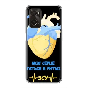 ЗСУ Чехлы (TPU) для Oppo A96 (Ритм ЗСУ)