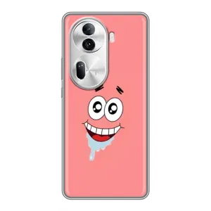 Чехлы с Патриком на Oppo Reno 11 Pro 5G (Мордочка Патрика)