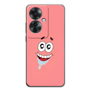 Чехлы с Патриком на OPPO Reno 11F (Мордочка Патрика)