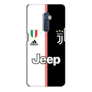 Чехлы с ТОП Футбольными клубами на Oppo Reno 2 (Juventus)