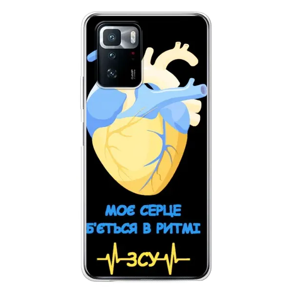 Чехол с рисунком «Ритм ЗСУ» для Xiaomi POCO X3 GT Чехол с рисунком «Ритм ЗСУ» для Xiaomi POCO X3 GT