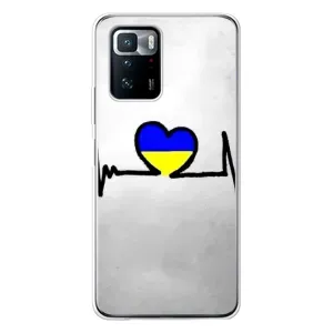 Силиконовый Чехол на Xiaomi POCO X3 GT (Я-Украина) (Украинская кардиограмма)