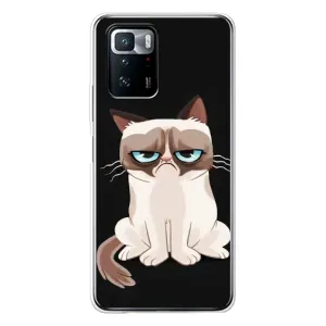Чехол на тематику: Коты для Xiaomi POCO X3 GT (Взгляд кота)