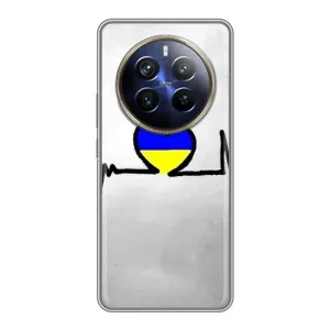 Силіконовий Чохол на Realme 12 Plus (Я-Україна) (Українська кардіограма)