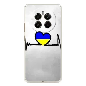 Силиконовый Чехол на Realme 13 4G (Я-Украина) (Украинская кардиограмма)