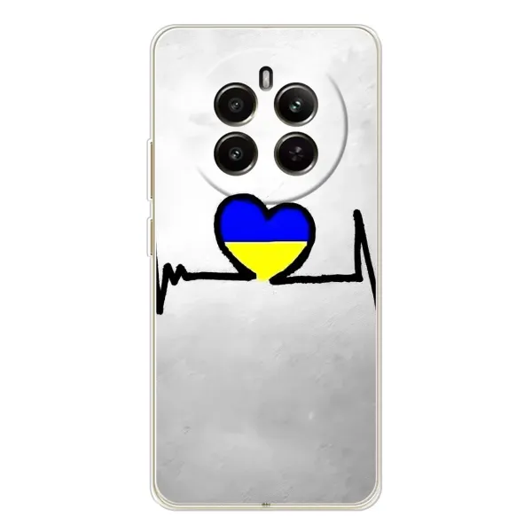 Чехол с рисунком «Украинская кардиограмма» для Realme 13 4G Чехол с рисунком «Украинская кардиограмма» для Realme 13 4G
