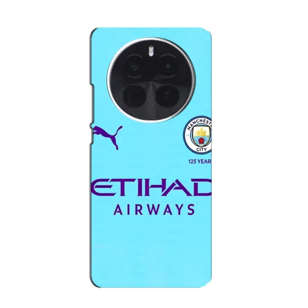 Чехол с рисунком «Man City» для Realme GT5 Pro Чехол с рисунком «Man City» для Realme GT5 Pro