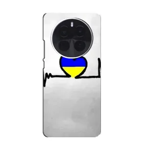 Силиконовый Чехол на Realme GT5 Pro (Я-Украина) (Украинская кардиограмма)