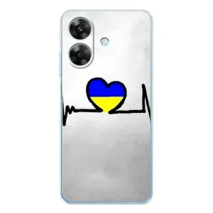 Силіконовий Чохол на Realme Note 60x (Я-Україна) (Українська кардіограма)