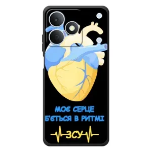 ЗСУ Чехлы (TPU) для RealMe Note 80 (Ритм ЗСУ)
