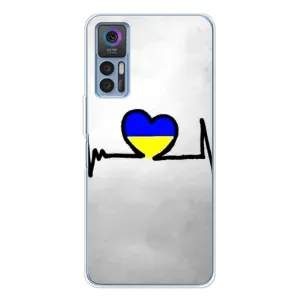 Силиконовый Чехол на TCL 30 Plus (Я-Украина) (Украинская кардиограмма)