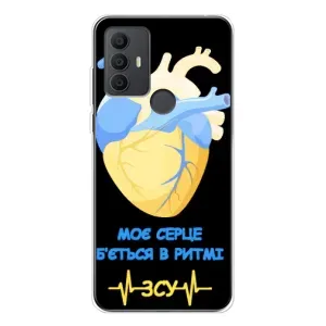 ЗСУ Чехлы (TPU) для TCL 306