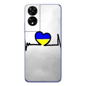 Силиконовый Чехол на TCL 505 (Я-Украина) (Украинская кардиограмма)