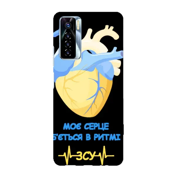 Чехол с рисунком «Ритм ЗСУ» для TECNO Camon 17 Pro Чехол с рисунком «Ритм ЗСУ» для TECNO Camon 17 Pro