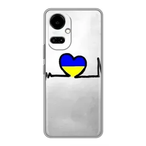 Силиконовый Чехол на TECNO Camon 19 (CI6n) / 19 Pro (CI8n) (Я-Украина) (Украинская кардиограмма)