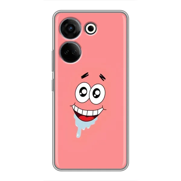 Чехол с рисунком «Мордочка Патрика» для TECNO Camon 20 Pro