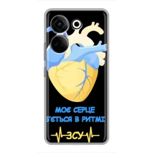 ЗСУ Чехлы (TPU) для Tecno Camon 20 Pro (Ритм ЗСУ)