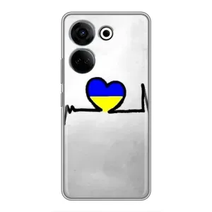 Силіконовий Чохол на Tecno Camon 20 Pro (Я-Україна) (Українська кардіограма)
