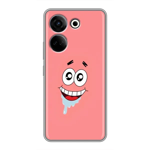 Чехол с рисунком «Мордочка Патрика» для TECNO Camon 20 Чехол с рисунком «Мордочка Патрика» для TECNO Camon 20
