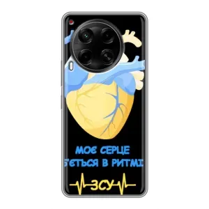 ЗСУ Чохли (TPU) для Tecno Camon 30 (CL6)