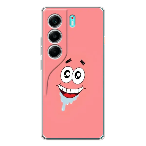 Чехол с рисунком «Мордочка Патрика» для TECNO Camon 40 Чехол с рисунком «Мордочка Патрика» для TECNO Camon 40