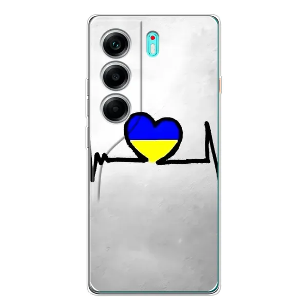 Чехол с рисунком «Украинская кардиограмма» для TECNO Camon 40 Чехол с рисунком «Украинская кардиограмма» для TECNO Camon 40