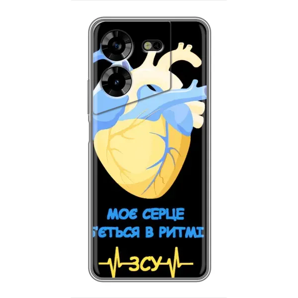 Чехол с рисунком «Ритм ЗСУ» для TECNO POVA 5 (LG7n) Чехол с рисунком «Ритм ЗСУ» для TECNO POVA 5 (LG7n)