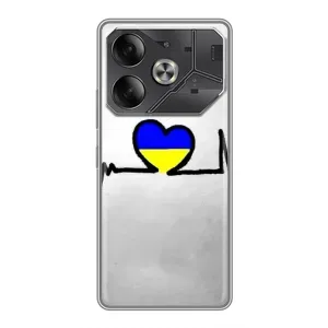 Силиконовый Чехол на Tecno Pova 6 (Я-Украина) (Украинская кардиограмма)