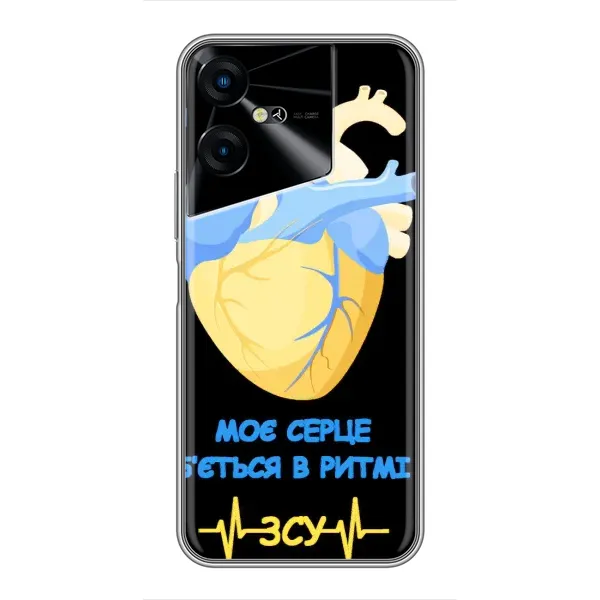 Чехол с рисунком «Ритм ЗСУ» для TECNO POVA Neo 3 Чехол с рисунком «Ритм ЗСУ» для TECNO POVA Neo 3